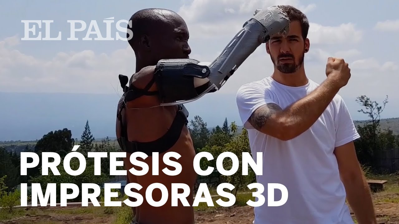 Impresión 3D en la fabricación de prótesis